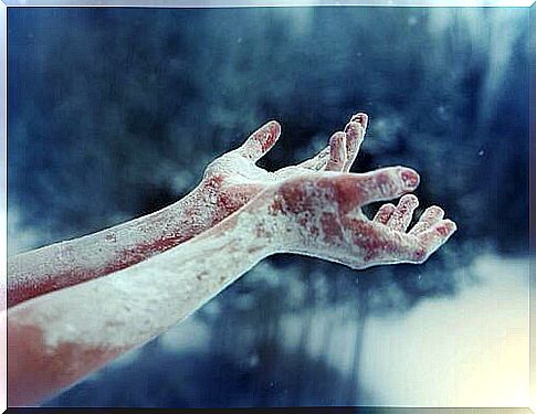 Hands covered with ice