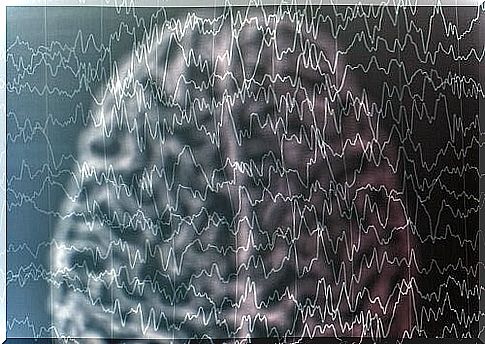 Lennox-Gastaut syndrome.  What is it?